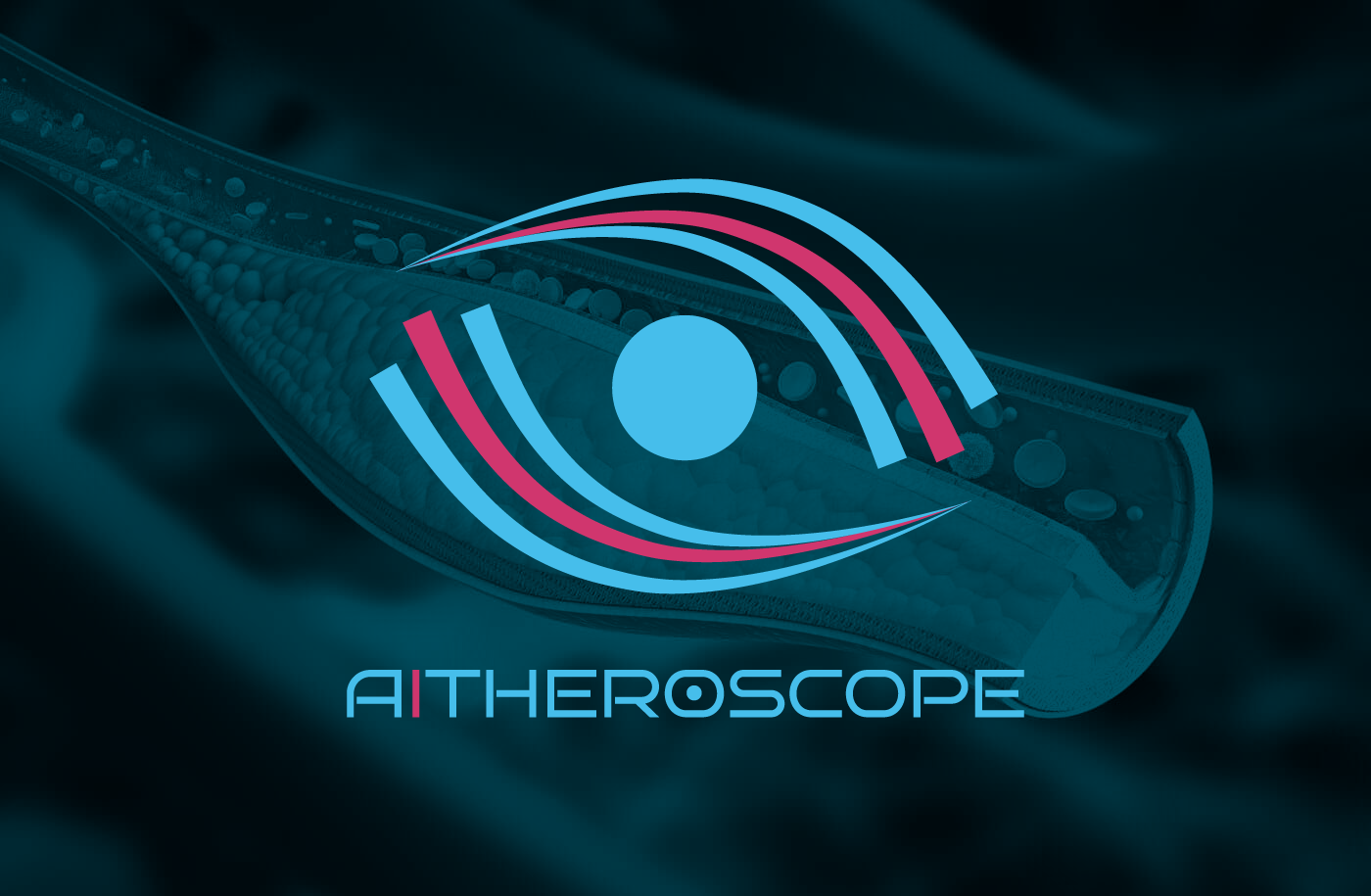 aitherescope