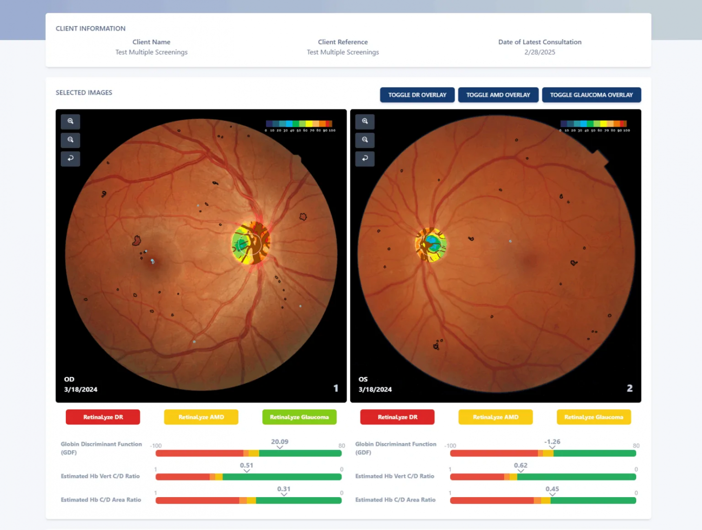 Imagen del modelo de la tecnología RetinaLyze